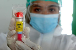 3 Komponen yang Bikin Tarif Tes PCR di Indonesia Mahal