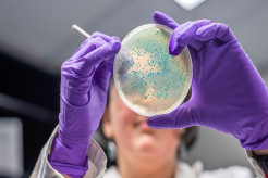 WHO Sebut AMR Berpotensi Jadi Silent Pandemic di Masa Depan, Ini Penjelasannya