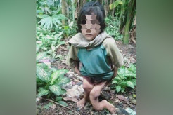 Miris! Bocah Perempuan di Nisel Disiksa, Kedua Kaki Patah dan Tidur di Kandang Ayam