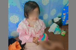 Bocah Nias Selatan Diduga Disiksa hingga Kaki Patah Diperiksa Dokter Spesialis Bedah Hari Ini