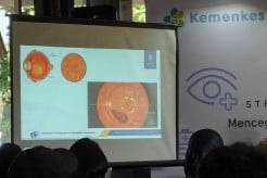 Penglihatan Kabur Belum Tentu Katarak, Bisa Jadi Retinopati Diabetik
