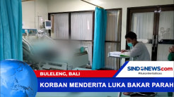 Balita Tersiram Air Panas