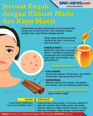 Jerawat Enyah dengan...