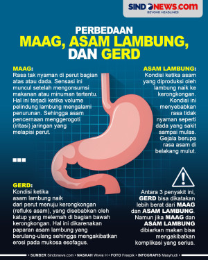 Serupa tapi Tak Sama,...