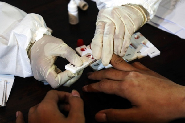 Lawan Corona, Nongkrong di Cafe Langsung Jalani Rapid Test