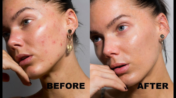 12 Cara Pakai Concealer untuk Tutupi Kekurangan dan Kesalahan Berdandan