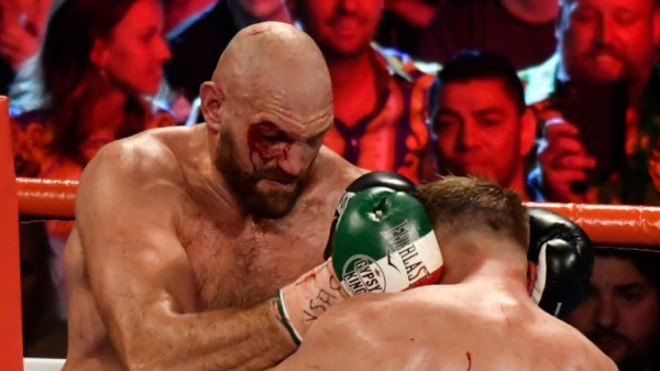Kisah Balas Budi Tyson Fury yang Karirnya Diselamatkan Capetillo