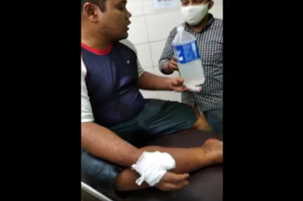 Viral! Aksi Brutal Sekelompok Pemuda Serang Warnet, 1 Orang Putus Jari Dibacok