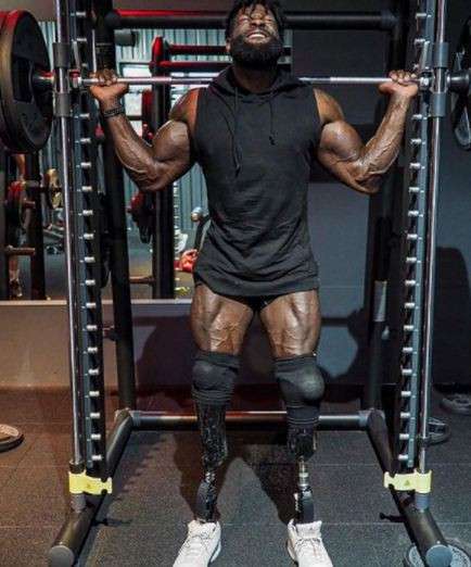 Kisah Tragis Edgard John-Augustin Bionic Body Kehilangan Dua Kaki