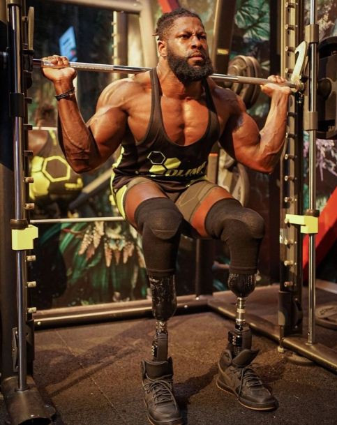 Kisah Tragis Edgard John-Augustin Bionic Body Kehilangan Dua Kaki