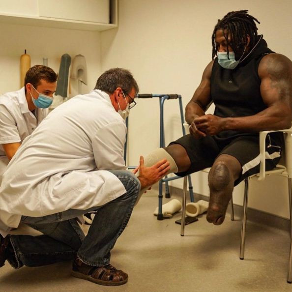 Kisah Tragis Edgard John-Augustin Bionic Body Kehilangan Dua Kaki