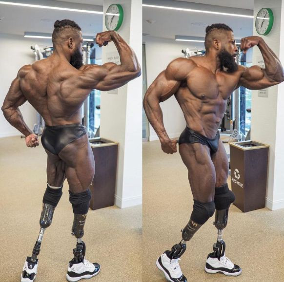 Kisah Tragis Edgard John-Augustin Bionic Body Kehilangan Dua Kaki