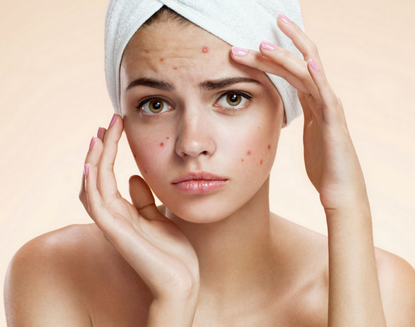Kandungan Skin Care yang Mesti Kamu Cek Sebelum Beli