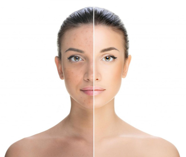 Kandungan Skin Care yang Mesti Kamu Cek Sebelum Beli