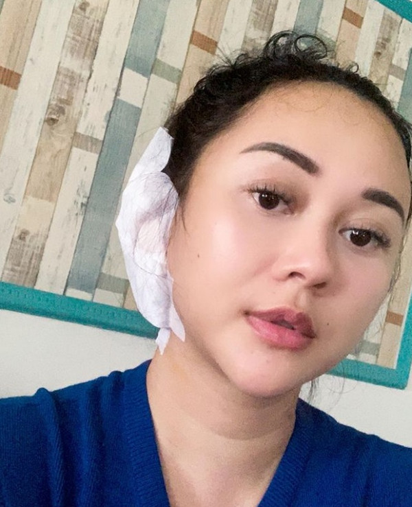 Gendang Telinga Aura Kasih Bocor, Begini Penjelasan Dokter