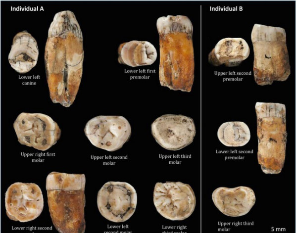 Gigi Kuno dari Kawin Silang Antara Manusia Neanderthal Ditemukan di Jersey