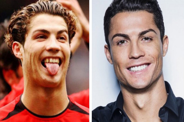 Deretan Gigi Paling Kinclong dan Rapi di Sepak Bola