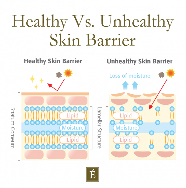 Sudah Ganti Skincare, tapi Wajah Masih Rusak? Mungkin Ini Penyebabnya