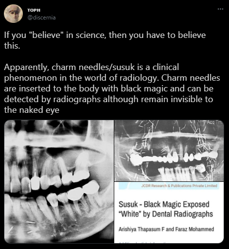 Viral Temuan Susuk pada Pemeriksaan Radiologi, Ini Penjelasan Medisnya