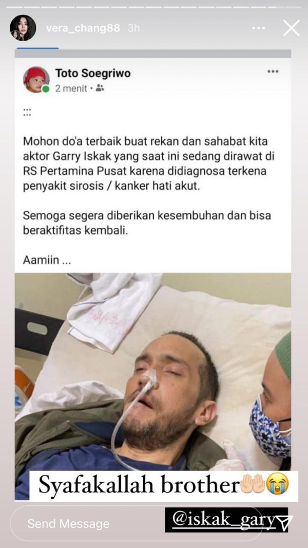 Gary Iskak Dirawat di Rumah Sakit Idap Kanker Hati