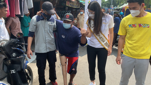Tunadaksa Penjual Bensin Eceran Dapat Kaki Palsu Gratis dari MNC Peduli