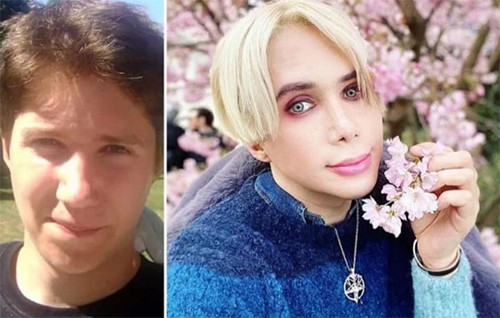 8 Tahun Jalani Oplas, Influencer Inggris Ini Bahagia Bisa Punya Wajah seperti Jimin BTS