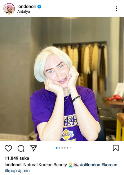 8 Tahun Jalani Oplas, Influencer Inggris Ini Bahagia Bisa Punya Wajah seperti Jimin BTS