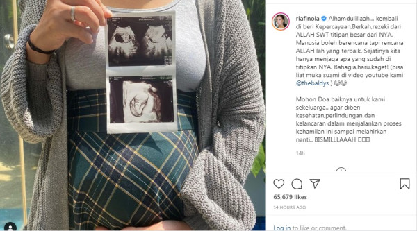 Hamil di Usia 43 Tahun, Nola B3 : Mohon Doa Baiknya untuk Kami Sekeluarga