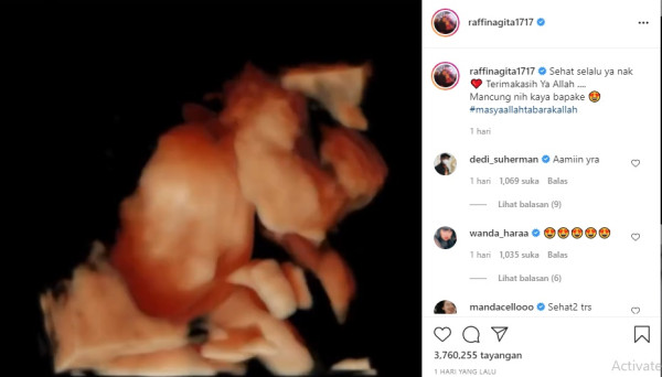 Raffi Ahmad Pamer Hasil USG Anak Kedua, Mancung Kayak Bapaknya