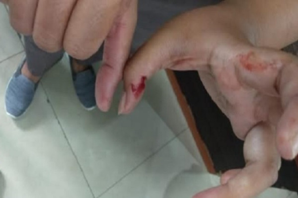 Korban Amukan Keluarga Pasien COVID-19 Melapor, Polisi Fasilitasi Mediasi