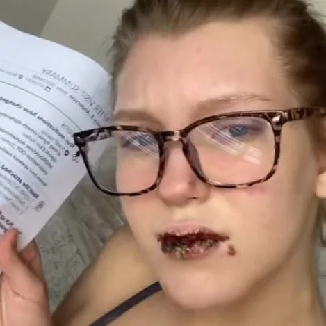 Bibir Wanita Ini Hitam Usai Minum Obat Jerawat Saat Terinfeksi Varian Delta