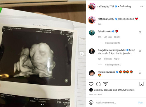 Nagita Slavina Bagikan Foto USG Adik Rafathar, Hidungnya Jadi Sorotan