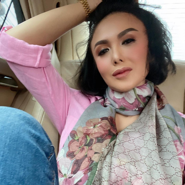 Bentuk Hidung Jadi Sorotan, Yuni Shara Dinilai Kurang Bersyukur