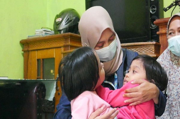 Ibunya Telah Tiada, di Tengah Kemiskinan Kembar Siam Putri dan Dewi Diasuh Sang Ayah