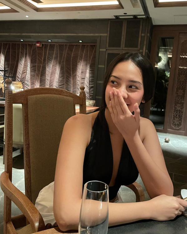 Anya Geraldine Pakai Tanktop Hitam, Lebam di Lengan Jadi Sorotan