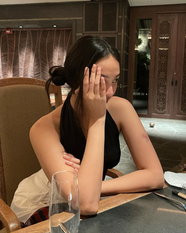 Anya Geraldine Pakai Tanktop Hitam, Lebam di Lengan Jadi Sorotan