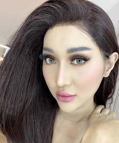 Inilah 5 Artis yang Pernah Lakukan Operasi Hidung