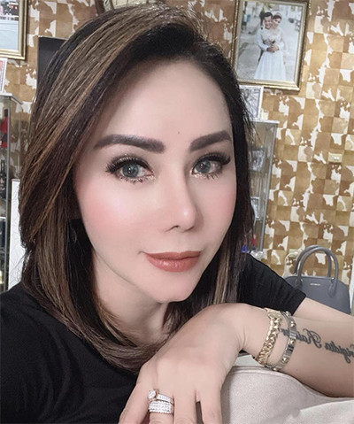 Inilah 5 Artis yang Pernah Lakukan Operasi Hidung