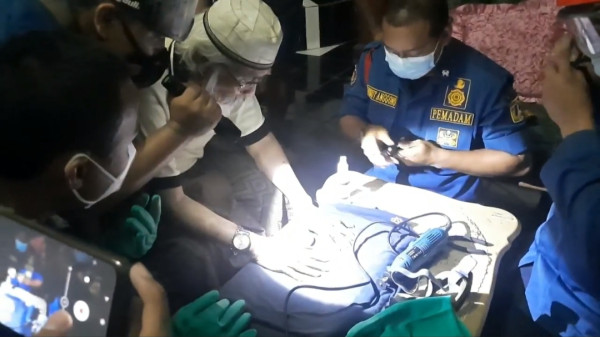 Cincin Batu Akik Tak Bisa Lepas dari Jari Kakek Ini, Damkar Turun Tangan