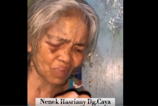 Keterlaluan! Nenek Jukir 62 Tahun Dikeroyok dan Uang Hasil Parkir Dirampas