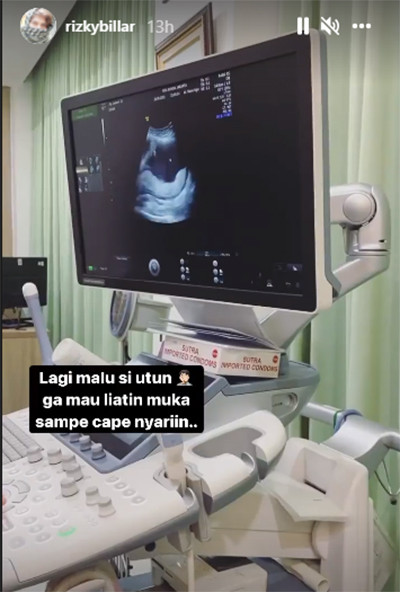 Terungkap, Usia Janin Lesti Kejora Masuk Trimester Dua dengan Panjang 14 Cm