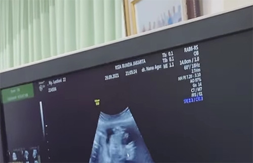 Terungkap, Usia Janin Lesti Kejora Masuk Trimester Dua dengan Panjang 14 Cm