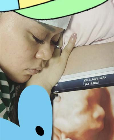 Rizky Billar Pamer Foto USG Anak, Hidung Mancungnya Curi Perhatian