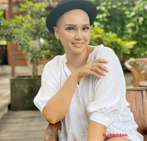 5 Artis yang Terkena Kanker dan Berhasil Sembuh, Epy Kusnandar hingga Pevita Pearce