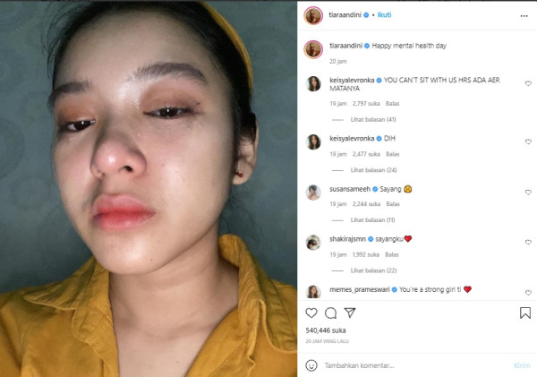 Rayakan Mental Health Day, Tiara Andini Unggah Foto Mata Sembab
