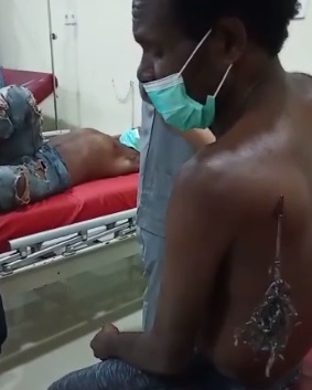 Abepura Mencekam, 2 Orang Terkena Panah saat Bentrokan Dua Kelompok Warga