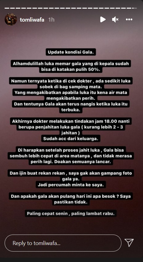 Anak Vanessa Angel Akan Dijahit, Ada Luka di Bagian Mata