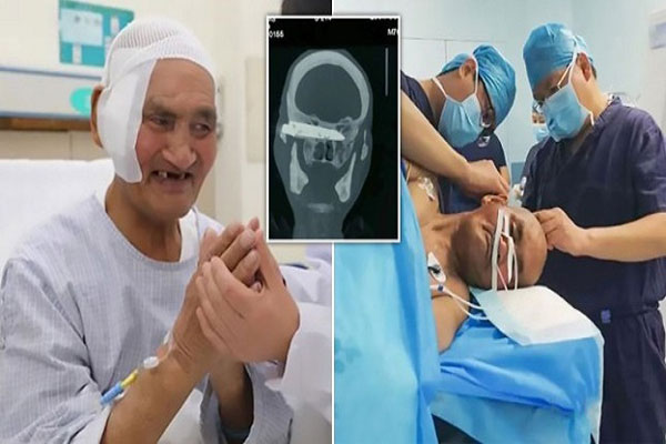 Dokter Cabut Pisau Setelah...