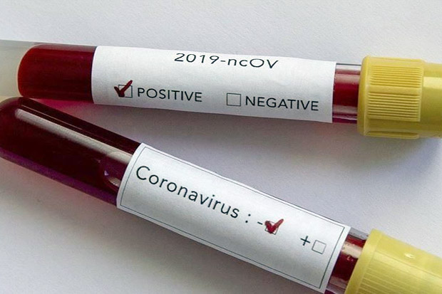 Peneliti: Antibodi SARS...