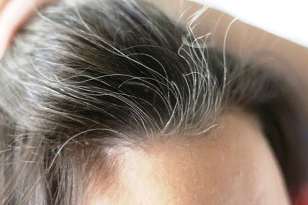 Bisakah Rambut Uban...